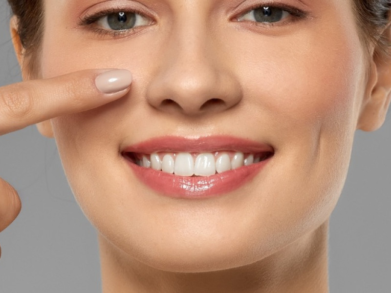 Botox in der Nasenzone in Javea