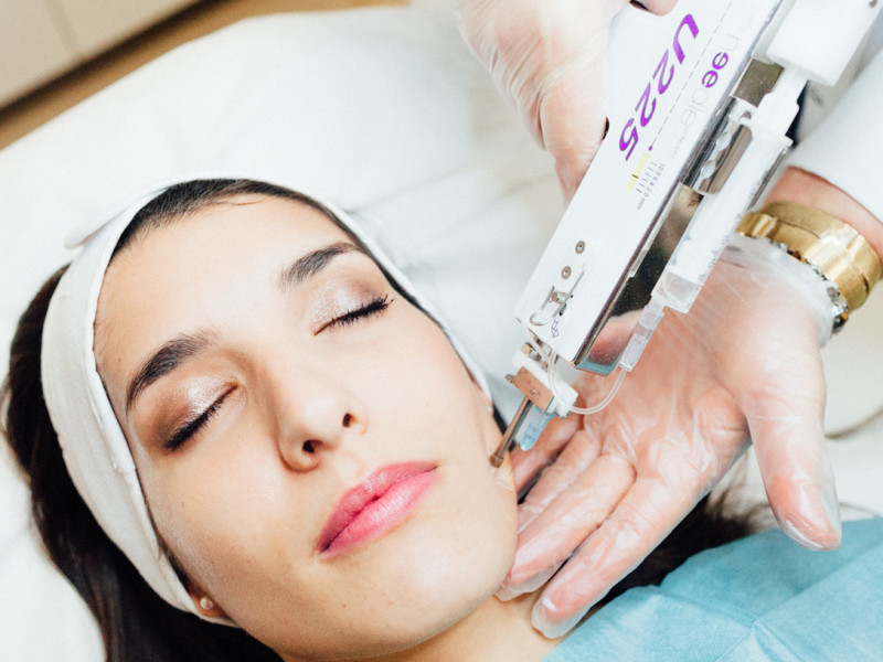 Gesichtsmesotherapie in Javea: Verjüngung und Revitalisierung | Estetica Javea - Dr. Caroline Carbasse