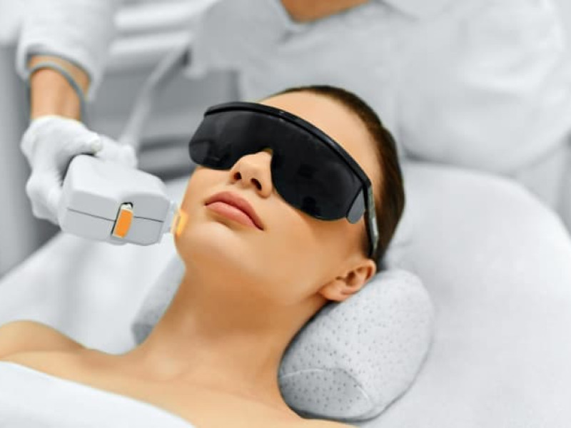Hautlaserbehandlungen mit IPL in Javea: Individuelle Expertise von Dr. Caroline Carbasse